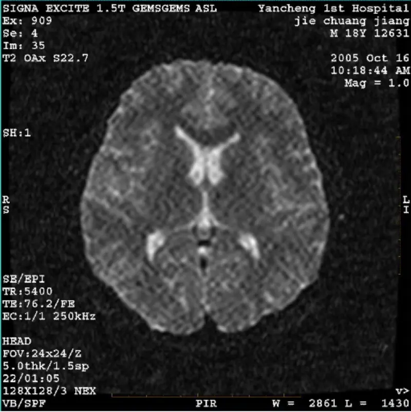 Obraz ARTIFACT WI/Fiesta Biały piksel